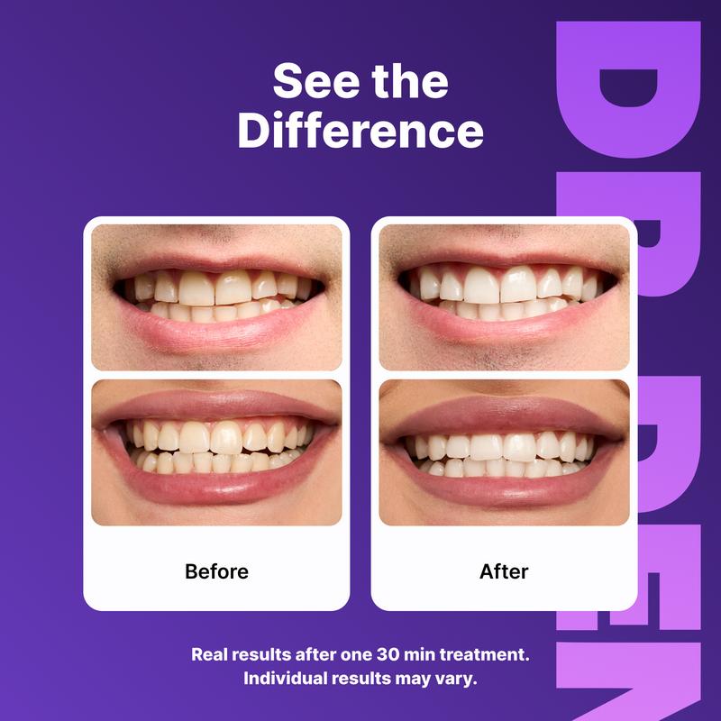 Dr. Dent Purple Teeth Whitening Strips – Fast Results, Zero Sensitivity
