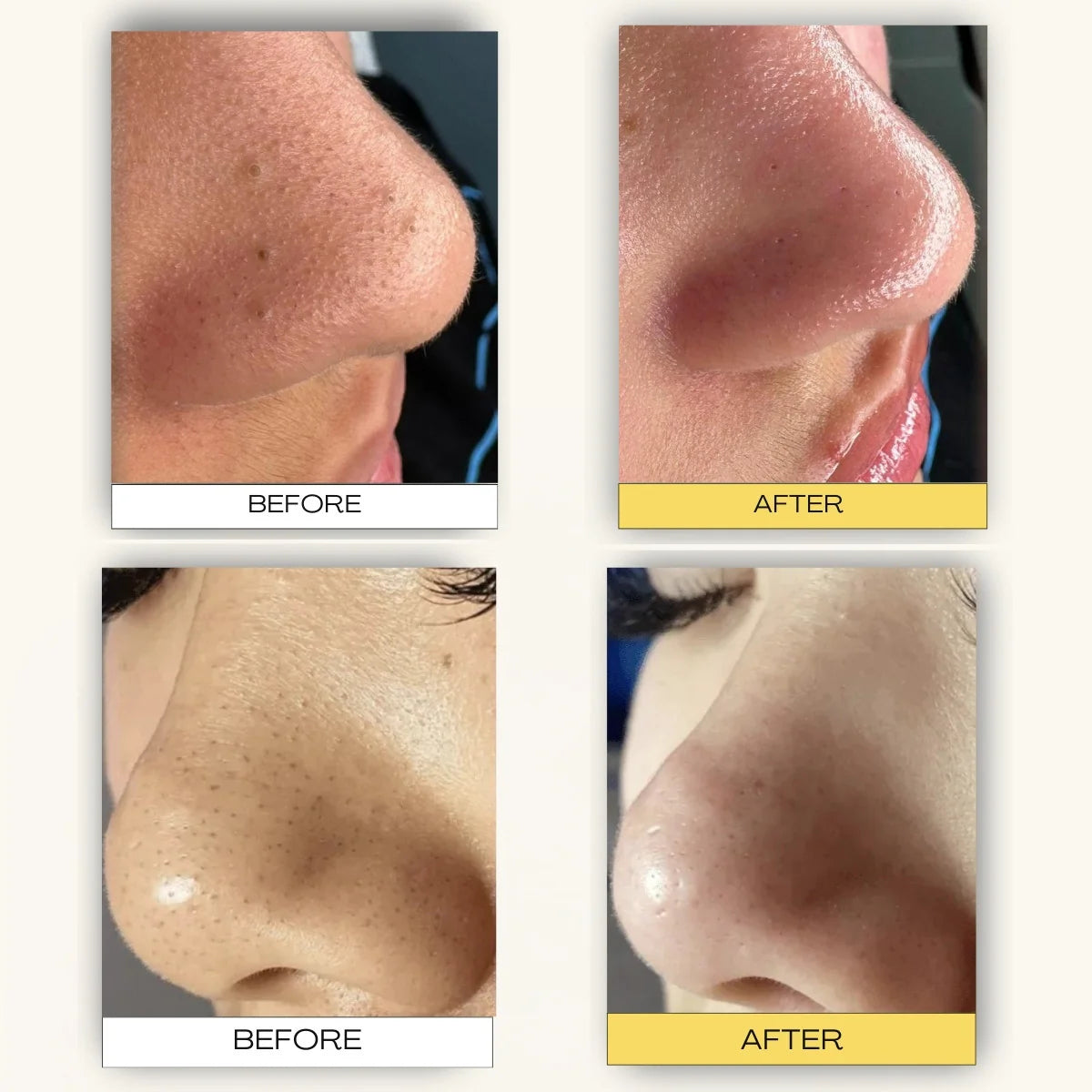 Pore Cleansing Patch-System FREE