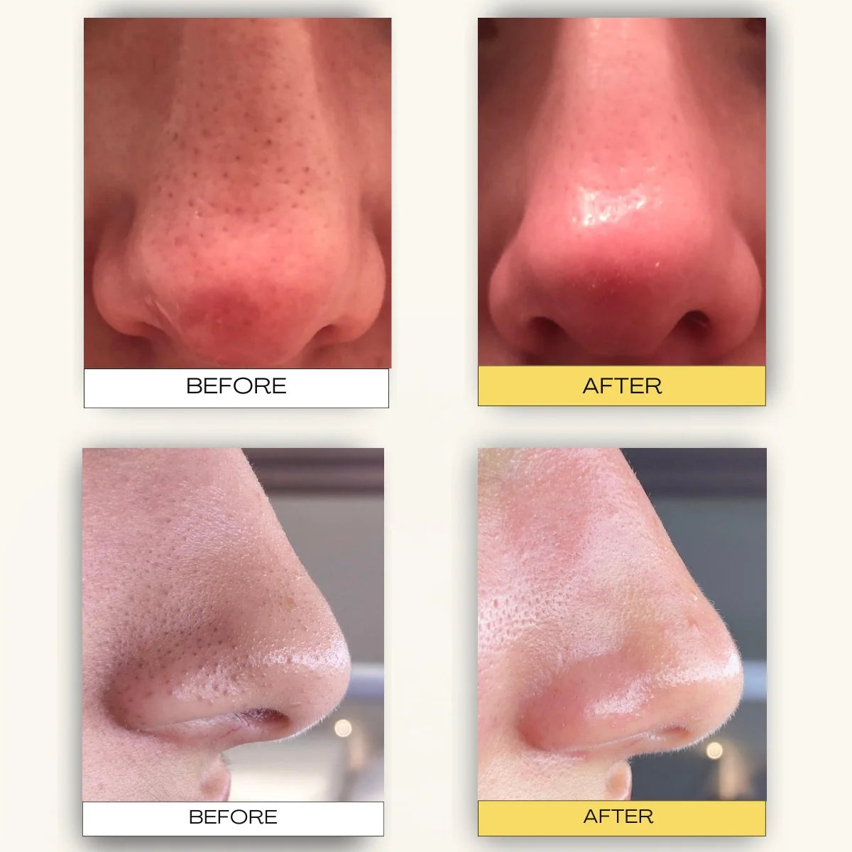 Pore Cleansing Patch-System FREE