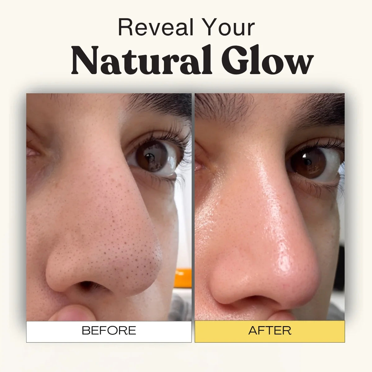 Pore Cleansing Patch-System FREE