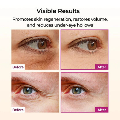 Dr. Melaxin Calcium Multi Balm – Korean Collagen Eye Stick for Fine Lines, Hydration & Firming 9g